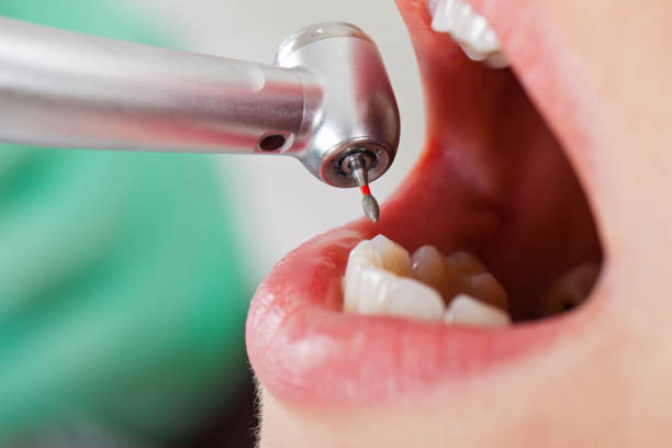 Best Emergency Dentist for Special Needs Patients in East Lake Orient Park, FL